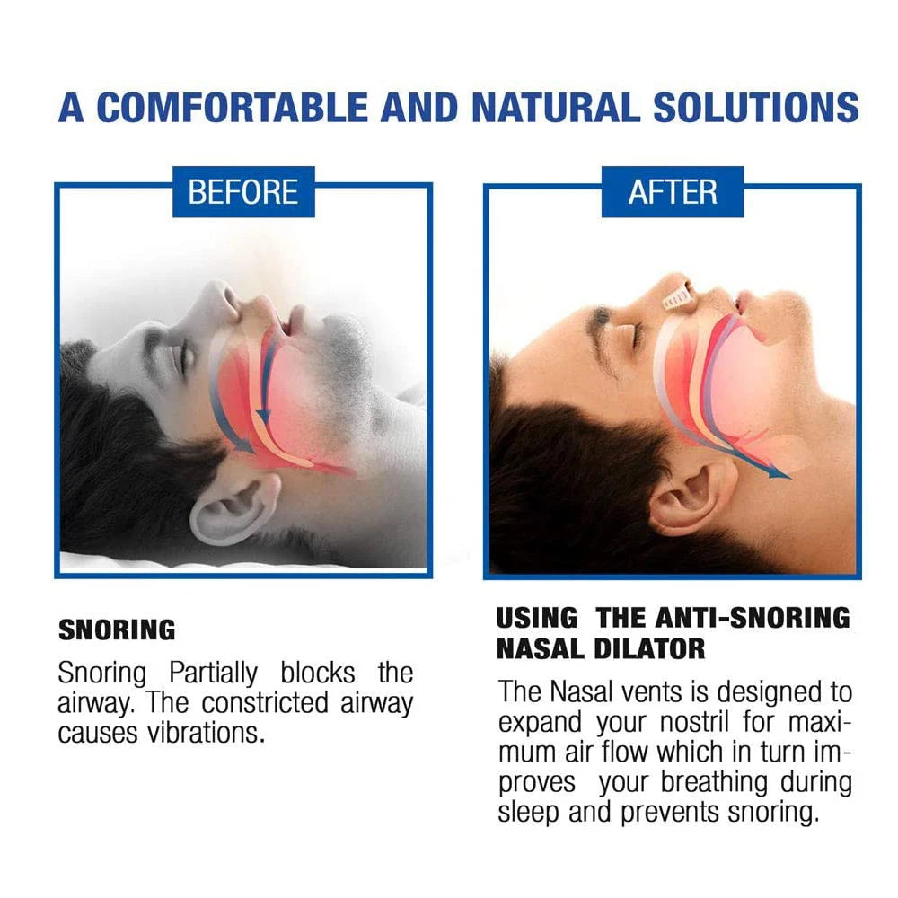 Dilatateur Nasal Anti-ronflement en Silicone souple de qualité médicale, 3 tailles différentes, Ventilation facile à respirer, aide au sommeil, pince-nez