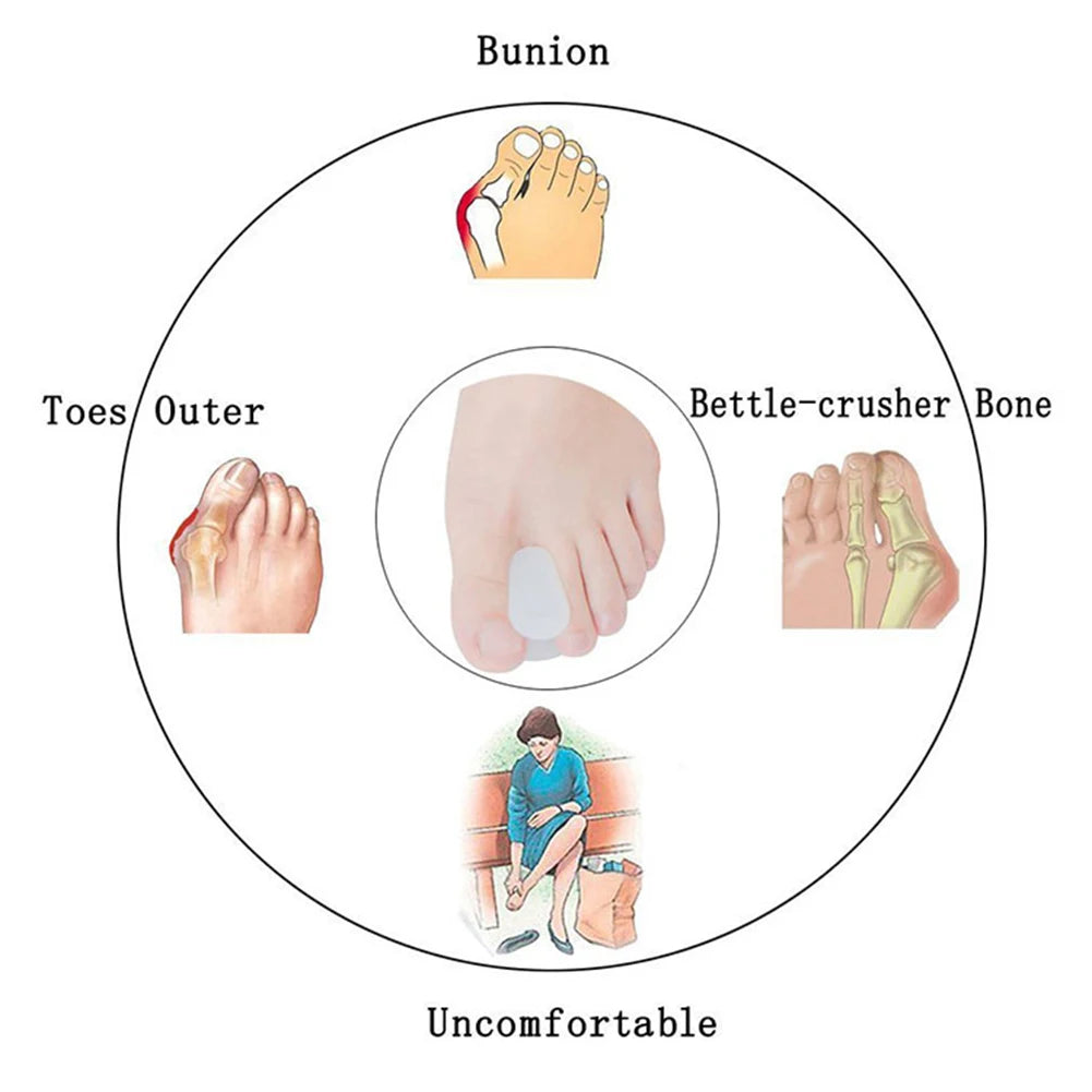 Orthèses de pouce en Silicone, 1 paire, correcteur d'os, séparateur d'orteils, Hallux Valgus, soins des pieds, 2020 S/L